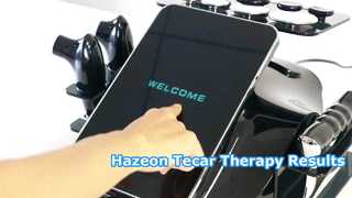 Терапевтический аппарат RL-W20 Hazeon Tecar — усовершенствованное устройство для физиотерапии и реабилитации с частотой 448 кГц
