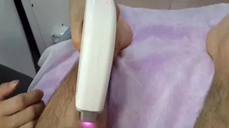 Non-Channel Fiber Coupled 808nm Diode Laser Hair Removal Machine with Germany Jenoptik Diode Arrays and Triple Cooling System